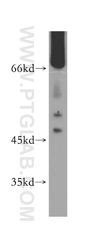 Western Blot (WB) analysis of A2780 cells using Kininogen 1 Polyclonal antibody (11926-1-AP)