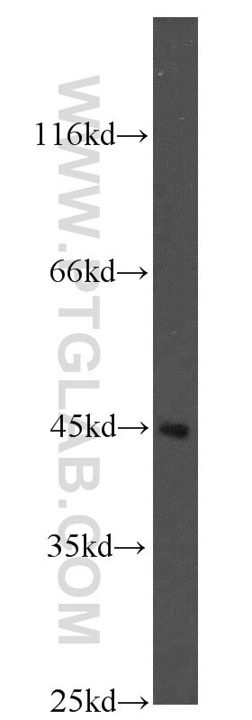 Western Blot (WB) analysis of HeLa cells using Kininogen 1 Polyclonal antibody (11926-1-AP)