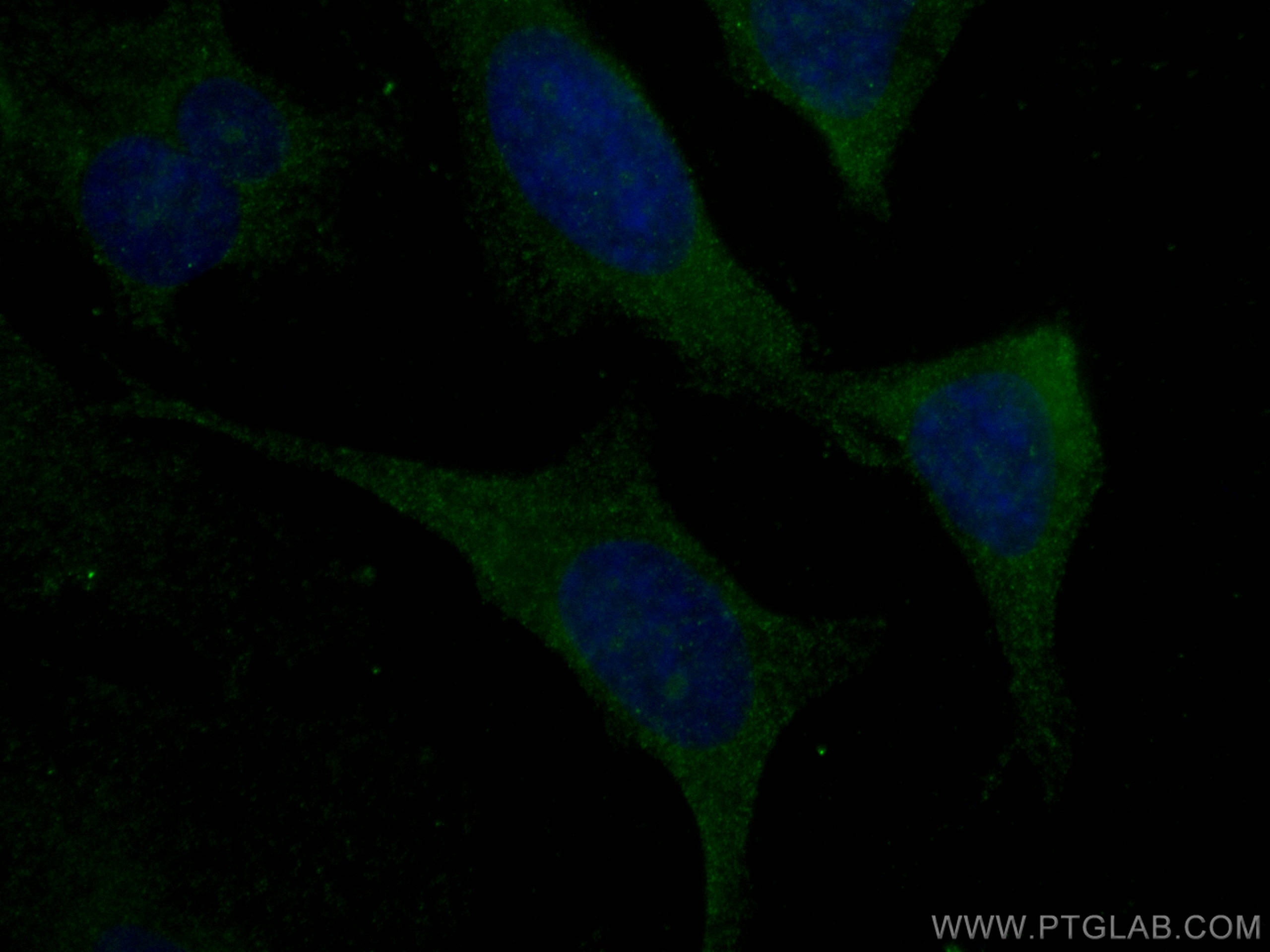 Immunofluorescence (IF) / fluorescent staining of HeLa cells using Kininogen 1 Monoclonal antibody (66123-1-Ig)