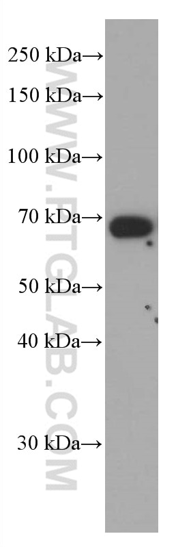 Western Blot (WB) analysis of human heart tissue using Kininogen 1 Monoclonal antibody (66123-1-Ig)