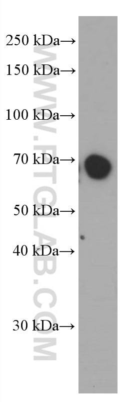 Western Blot (WB) analysis of human placenta tissue using Kininogen 1 Monoclonal antibody (66123-1-Ig)