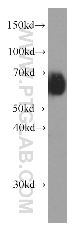 Western Blot (WB) analysis of human plasma using Kininogen 1 Monoclonal antibody (66123-1-Ig)