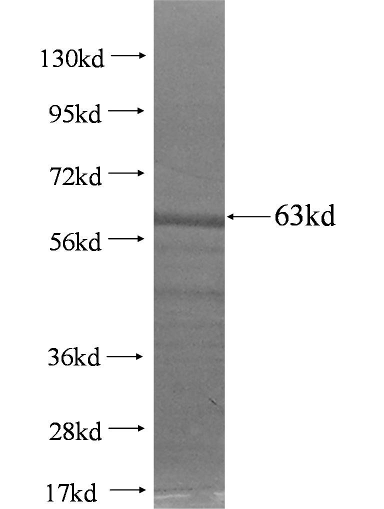 KNG1 fusion protein Ag2574 SDS-PAGE
