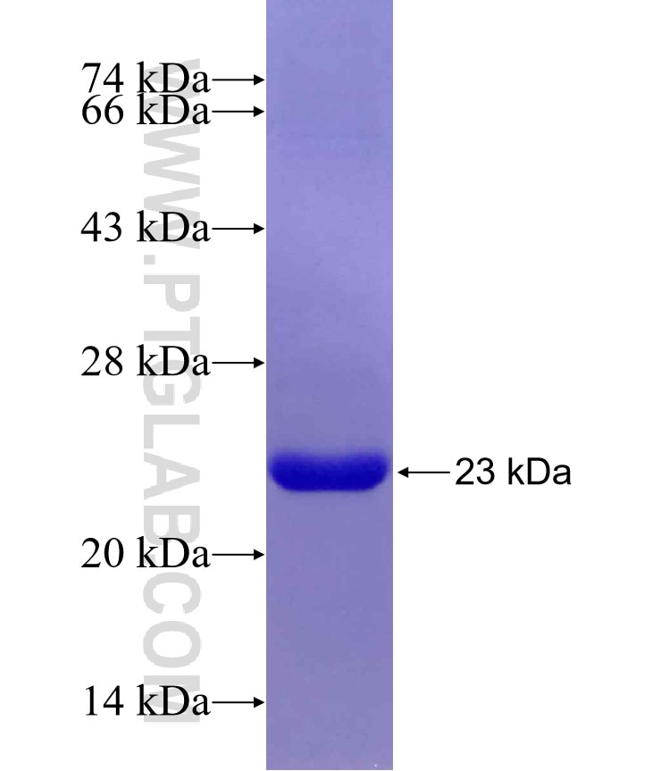 KNL1 fusion protein Ag29881 SDS-PAGE