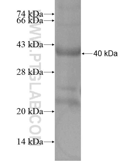 KNTC1 fusion protein Ag20268 SDS-PAGE