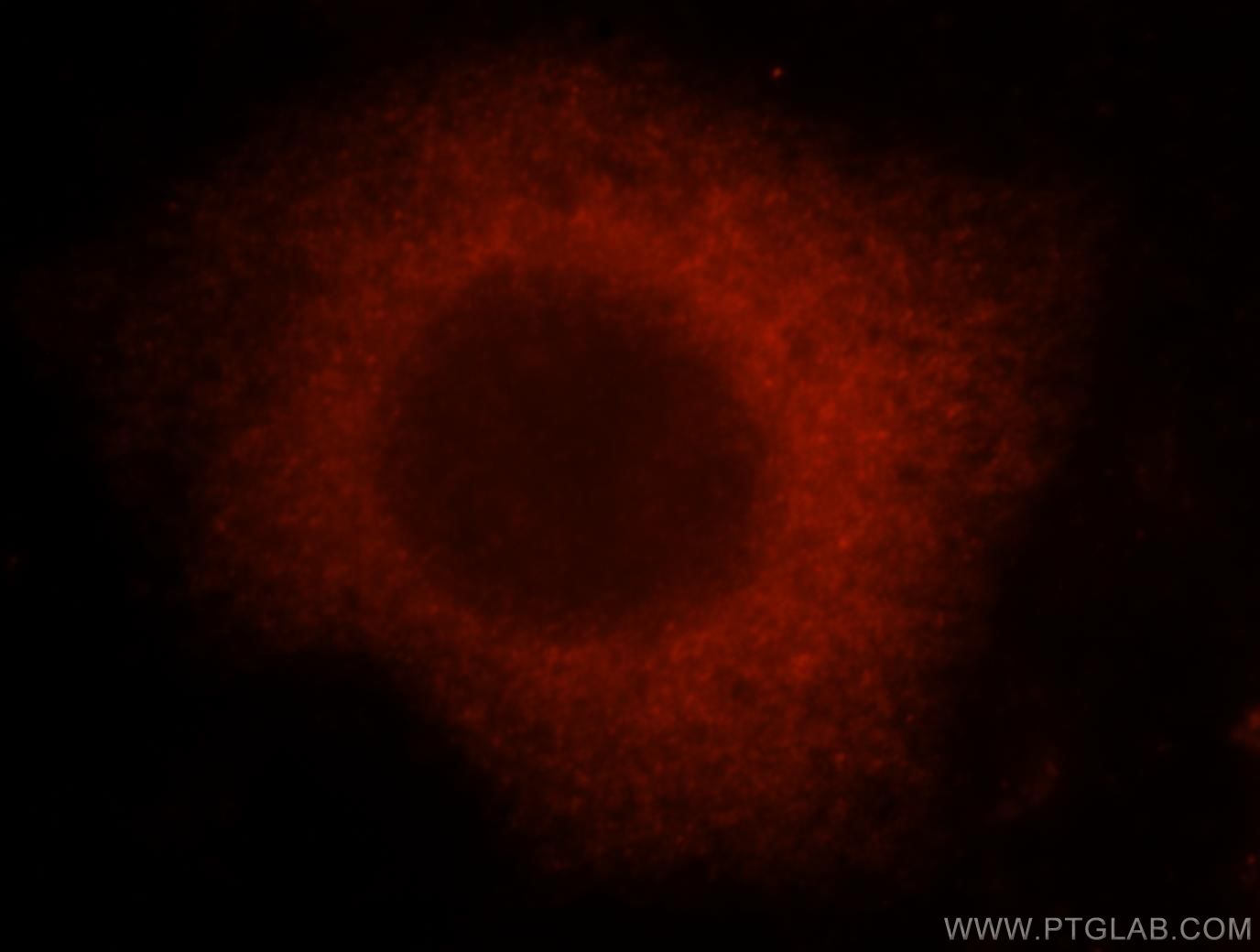 Immunofluorescence (IF) / fluorescent staining of MCF-7 cells using Importin Alpha 5 Polyclonal antibody (18137-1-AP)