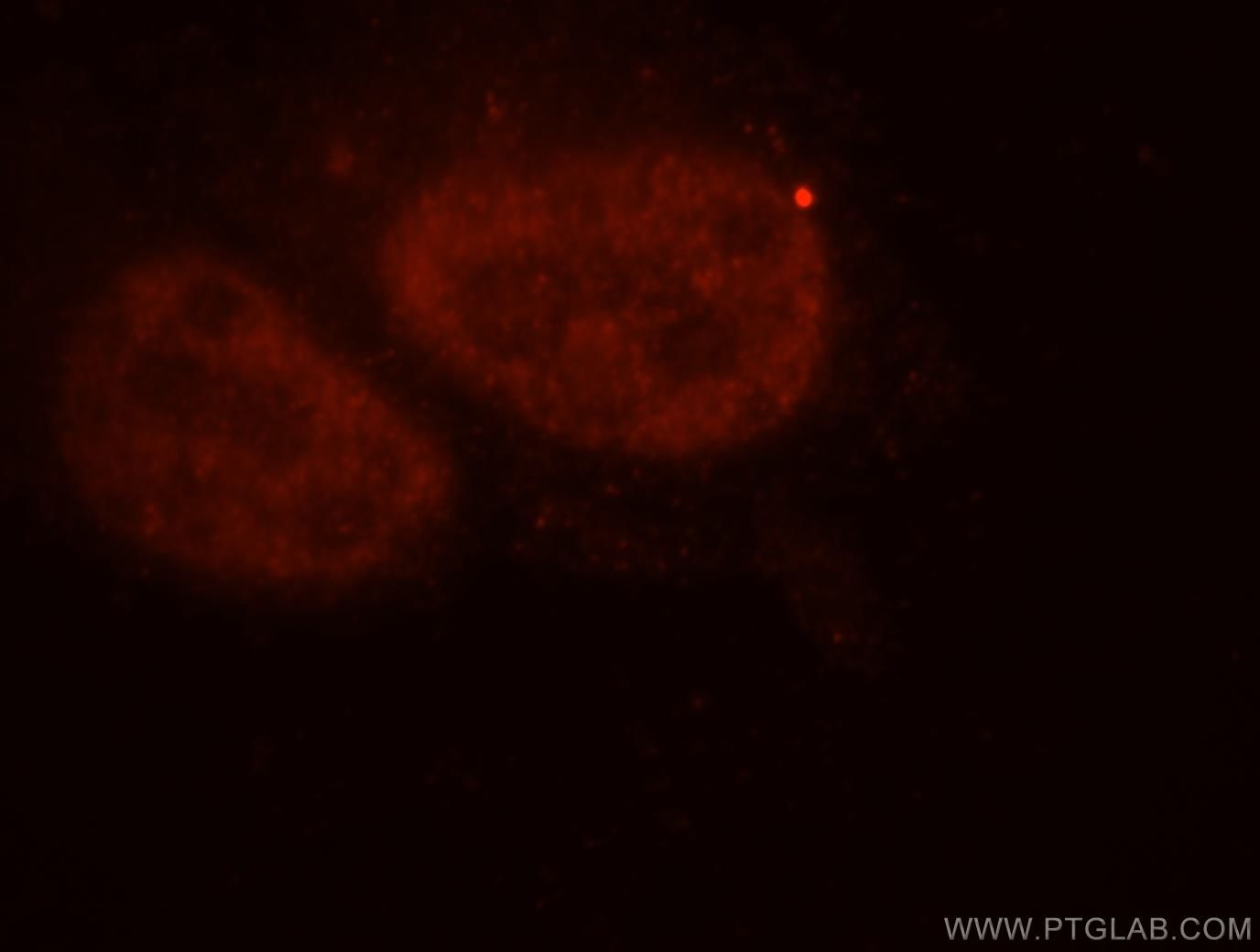 Immunofluorescence (IF) / fluorescent staining of HepG2 cells using Importin Alpha 5 Polyclonal antibody (18137-1-AP)