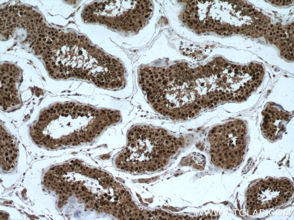 Immunohistochemistry (IHC) staining of human testis tissue using Importin Alpha 5 Polyclonal antibody (18137-1-AP)