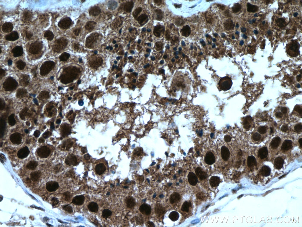 Immunohistochemistry (IHC) staining of human testis tissue using Importin Alpha 5 Polyclonal antibody (18137-1-AP)