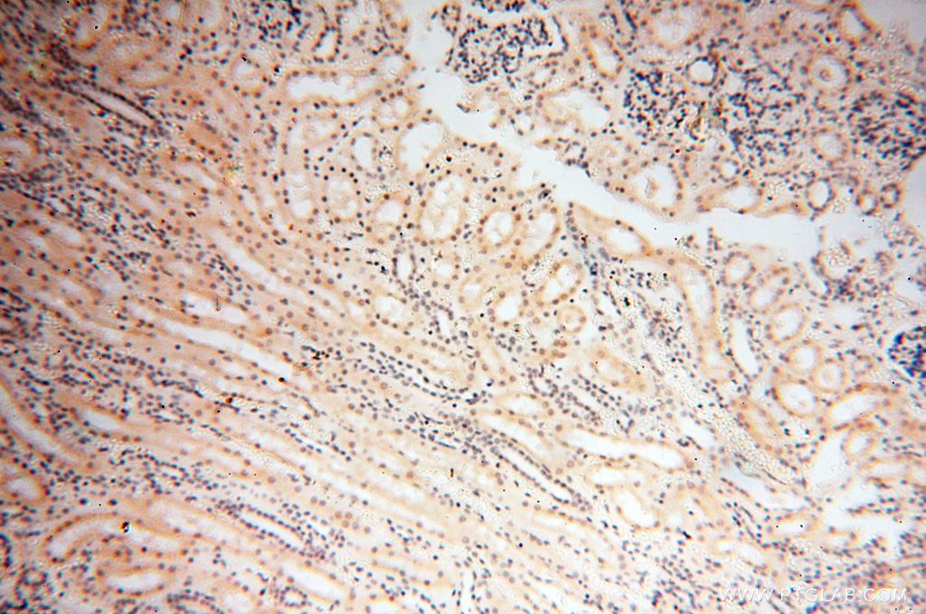 Immunohistochemistry (IHC) staining of human kidney tissue using Importin Alpha 5 Polyclonal antibody (18137-1-AP)