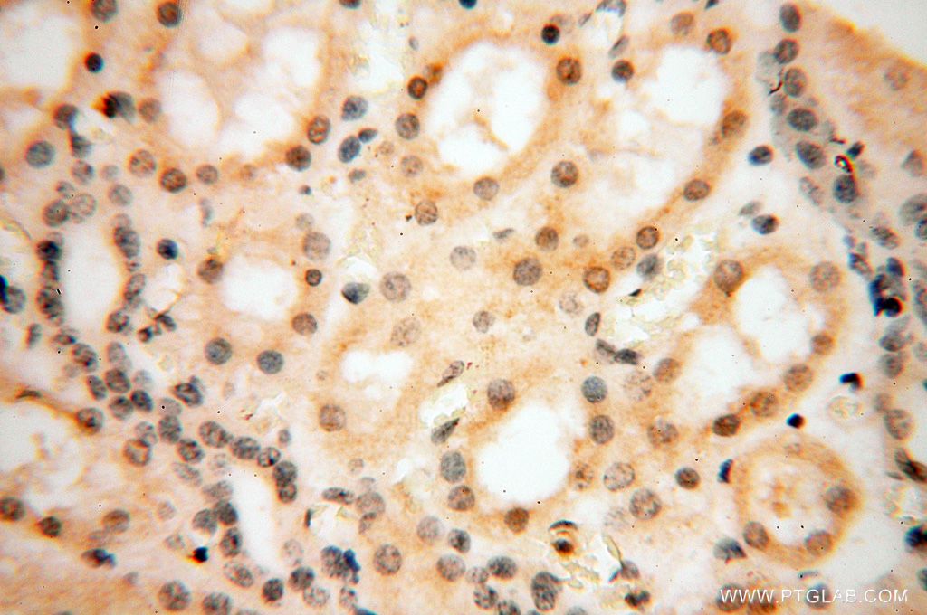 Immunohistochemistry (IHC) staining of human kidney tissue using Importin Alpha 5 Polyclonal antibody (18137-1-AP)