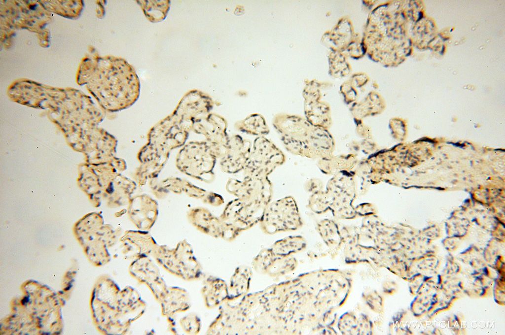 Immunohistochemistry (IHC) staining of human placenta tissue using Importin Alpha 5 Polyclonal antibody (18137-1-AP)