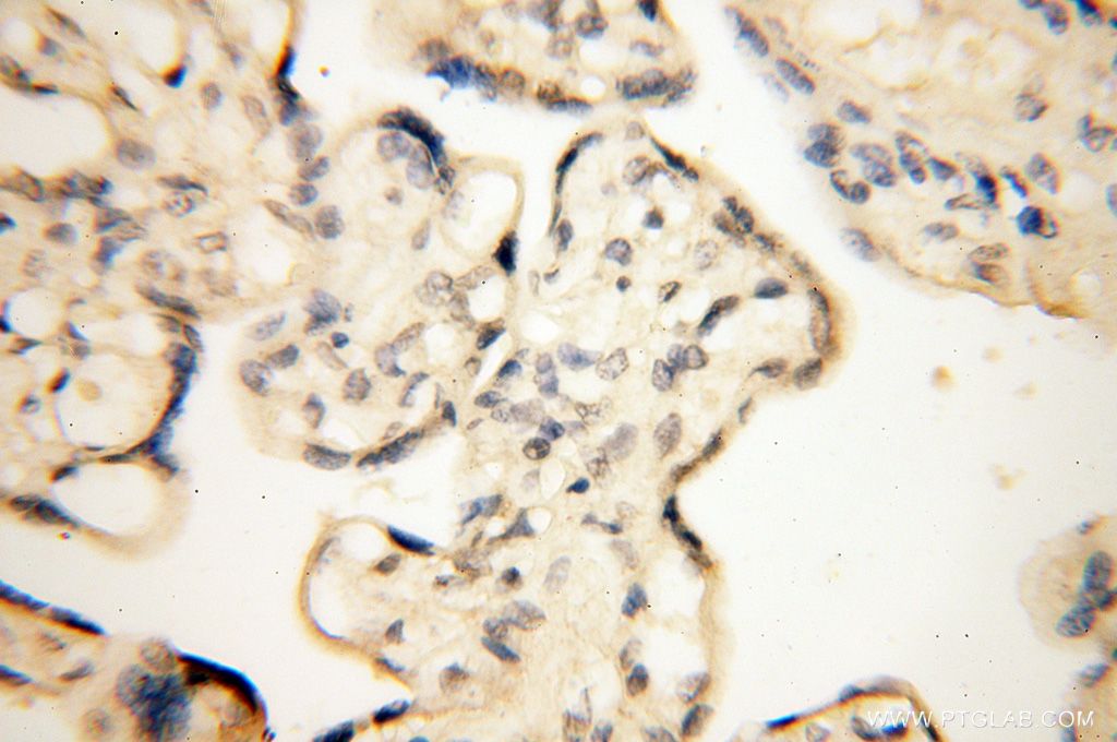 Immunohistochemistry (IHC) staining of human placenta tissue using Importin Alpha 5 Polyclonal antibody (18137-1-AP)