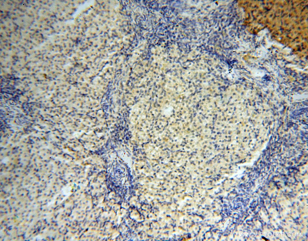 Immunohistochemistry (IHC) staining of human ovary tissue using Importin Alpha 5 Polyclonal antibody (18137-1-AP)