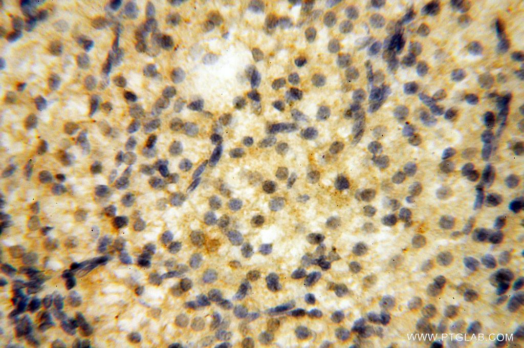 Immunohistochemistry (IHC) staining of human ovary tissue using Importin Alpha 5 Polyclonal antibody (18137-1-AP)