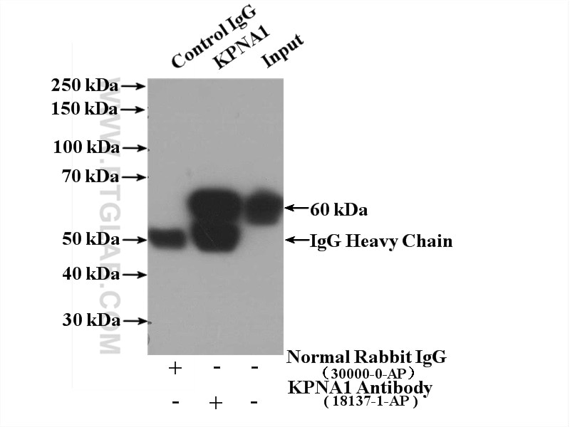 Immunoprecipitation (IP) experiment of HEK-293 cells using Importin Alpha 5 Polyclonal antibody (18137-1-AP)