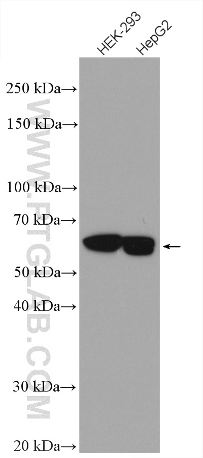 Western Blot (WB) analysis of various lysates using Importin Alpha 5 Polyclonal antibody (18137-1-AP)