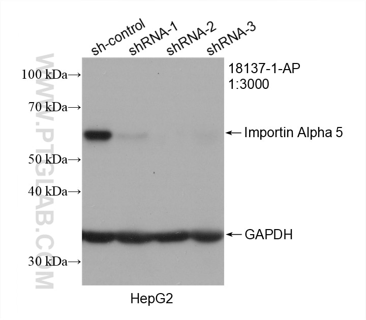Western Blot (WB) analysis of HepG2 cells using Importin Alpha 5 Polyclonal antibody (18137-1-AP)
