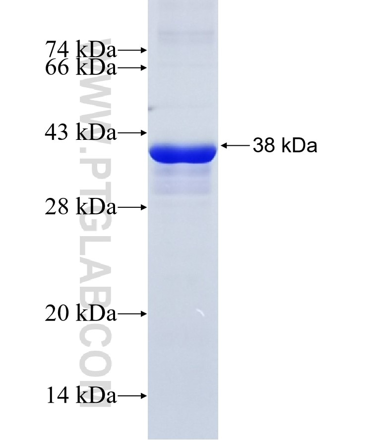 KPNA1 fusion protein Ag12751 SDS-PAGE