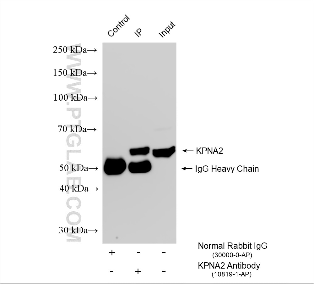 Immunoprecipitation (IP) experiment of HepG2 cells using KPNA2 Polyclonal antibody (10819-1-AP)