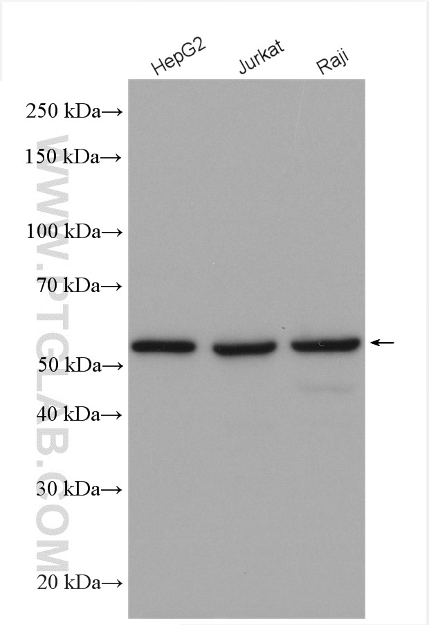 Western Blot (WB) analysis of various lysates using KPNA2 Polyclonal antibody (10819-1-AP)