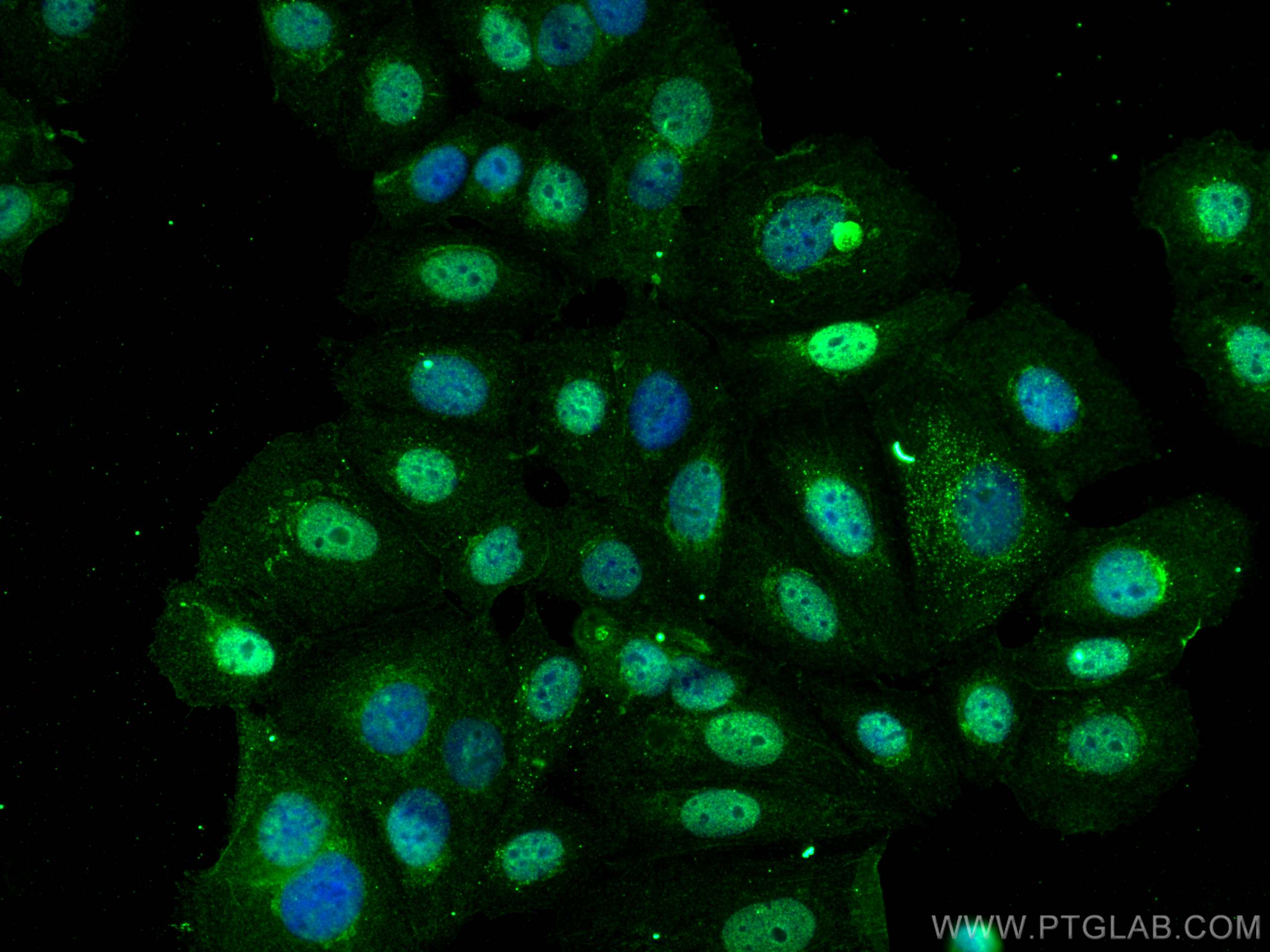 Immunofluorescence (IF) / fluorescent staining of MCF-7 cells using KPNA2 Monoclonal antibody (66870-1-Ig)
