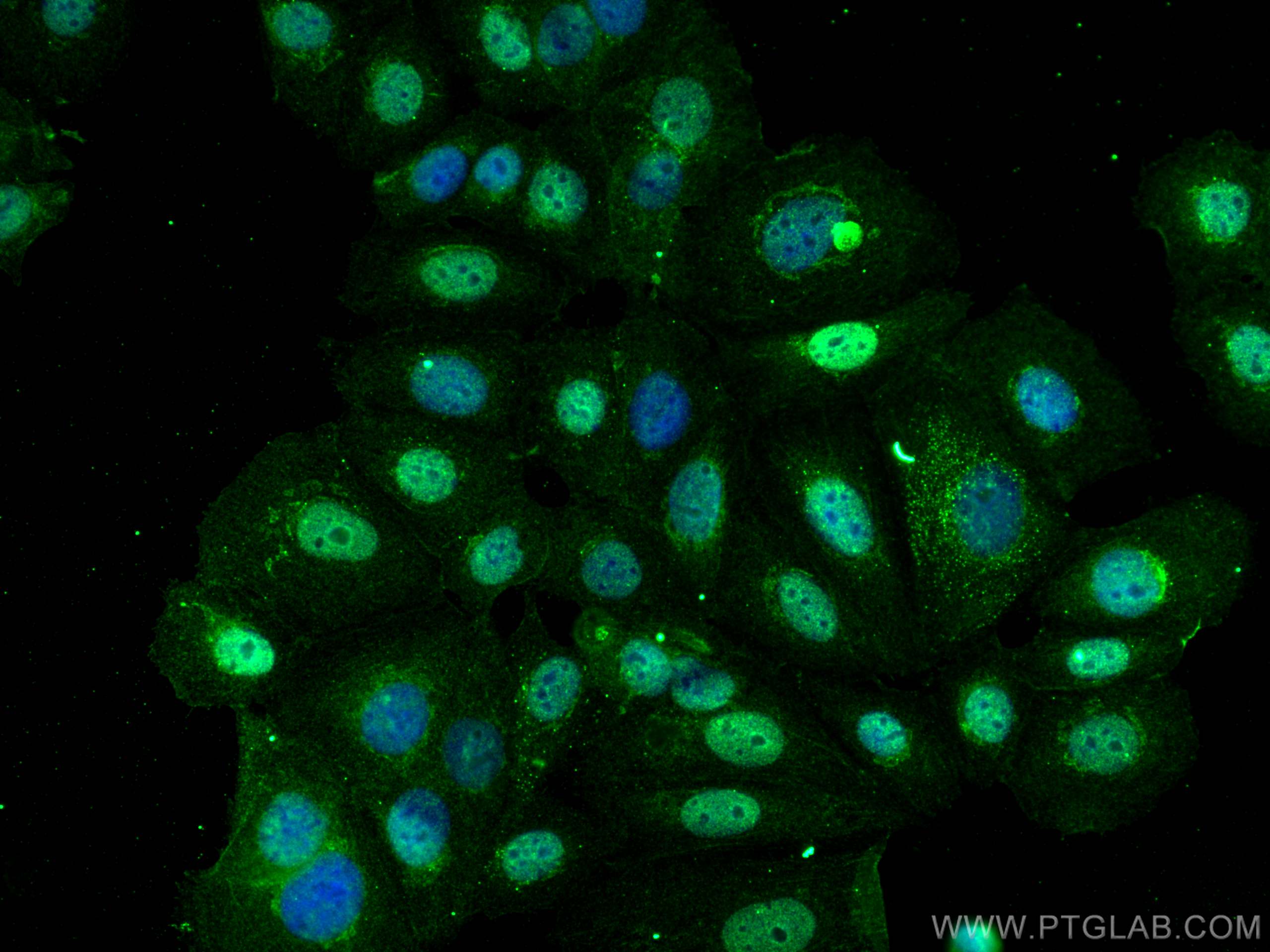 IF Staining of MCF-7 using 66870-1-Ig