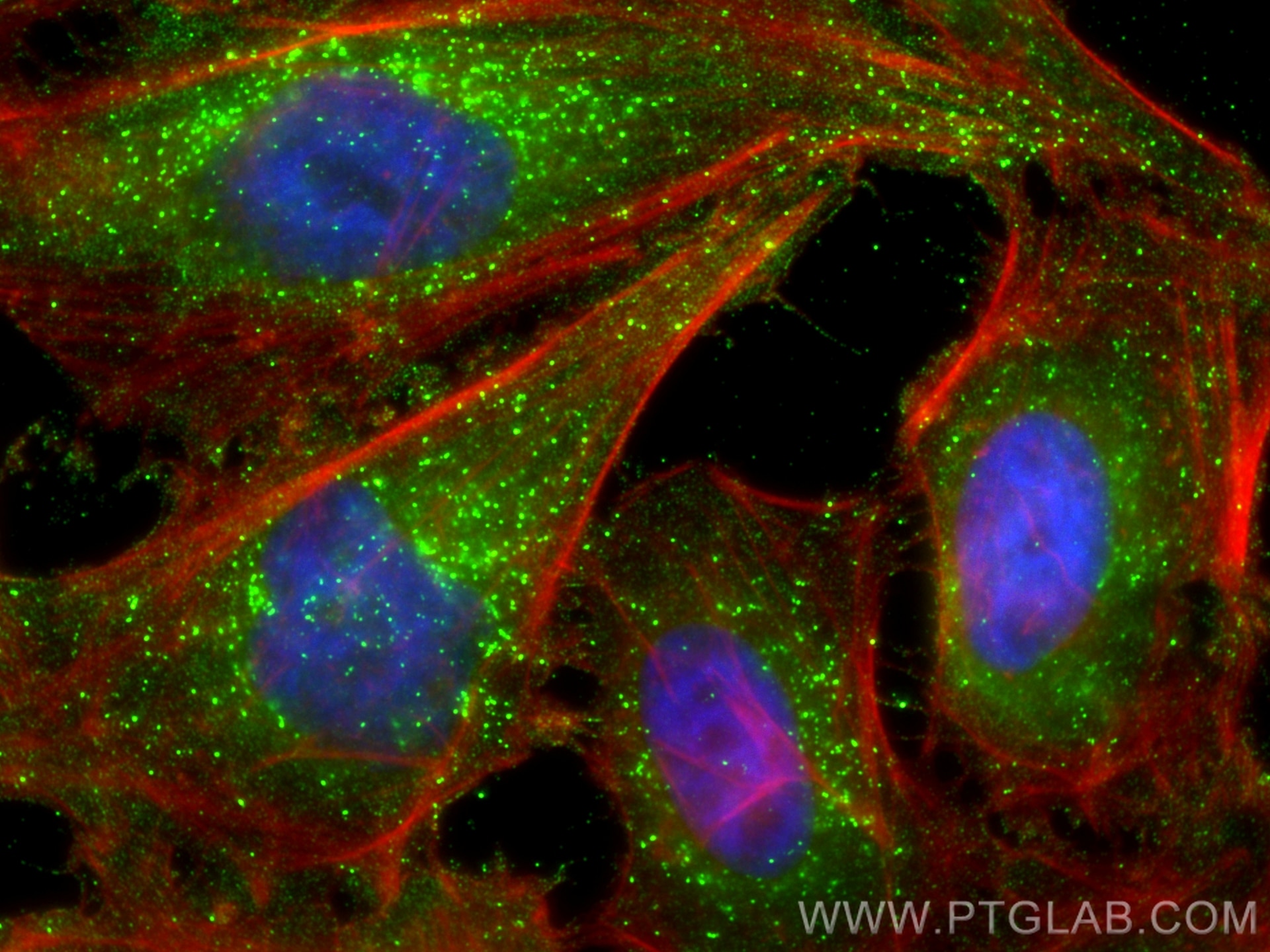 Immunofluorescence (IF) / fluorescent staining of HeLa cells using KPNA2 Monoclonal antibody (66870-1-Ig)