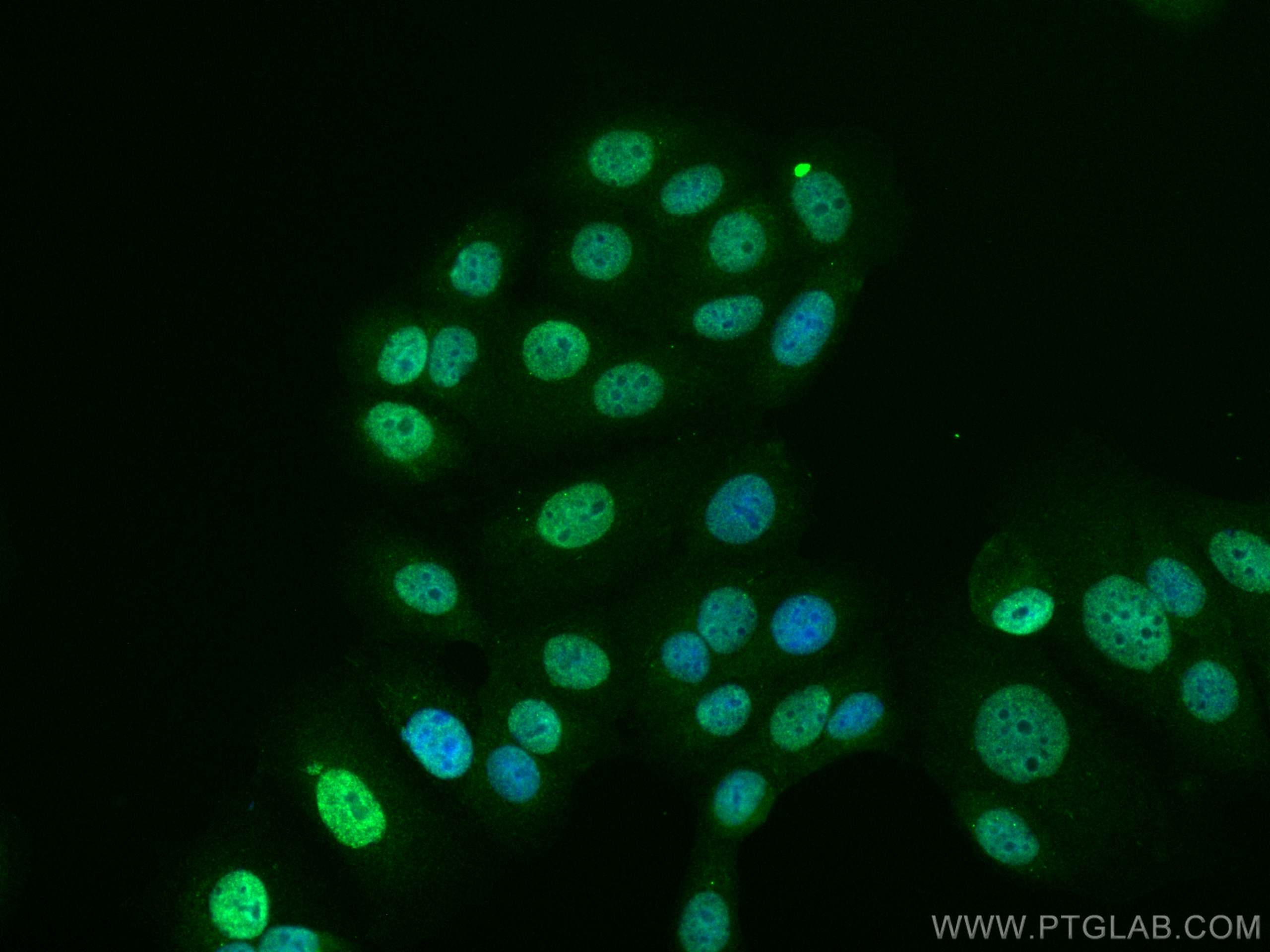 Immunofluorescence (IF) / fluorescent staining of MCF-7 cells using CoraLite® Plus 488-conjugated KPNA2 Monoclonal ant (CL488-66870)
