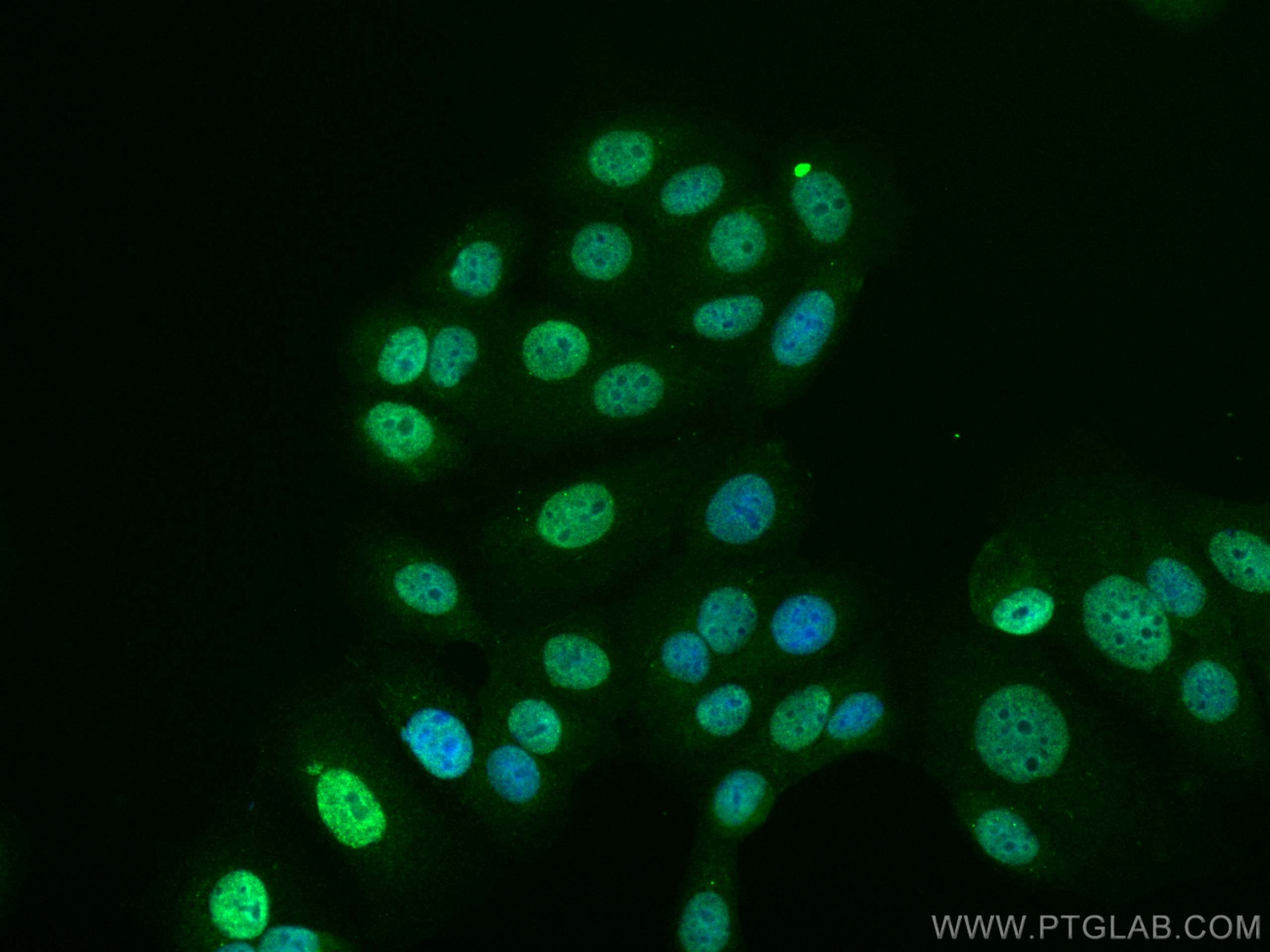 IF Staining of MCF-7 using CL488-66870