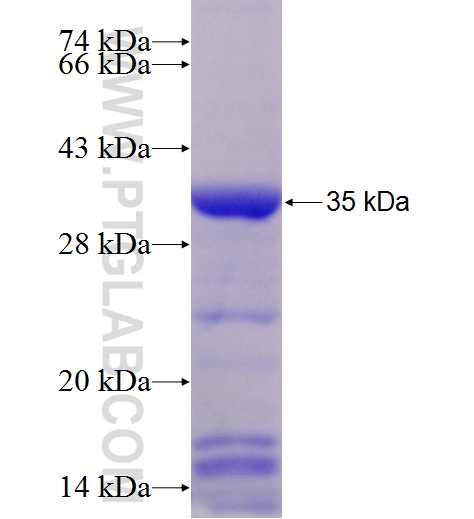 KPNA2 fusion protein Ag28386 SDS-PAGE
