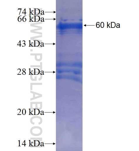 KPNA2 fusion protein Ag1153 SDS-PAGE