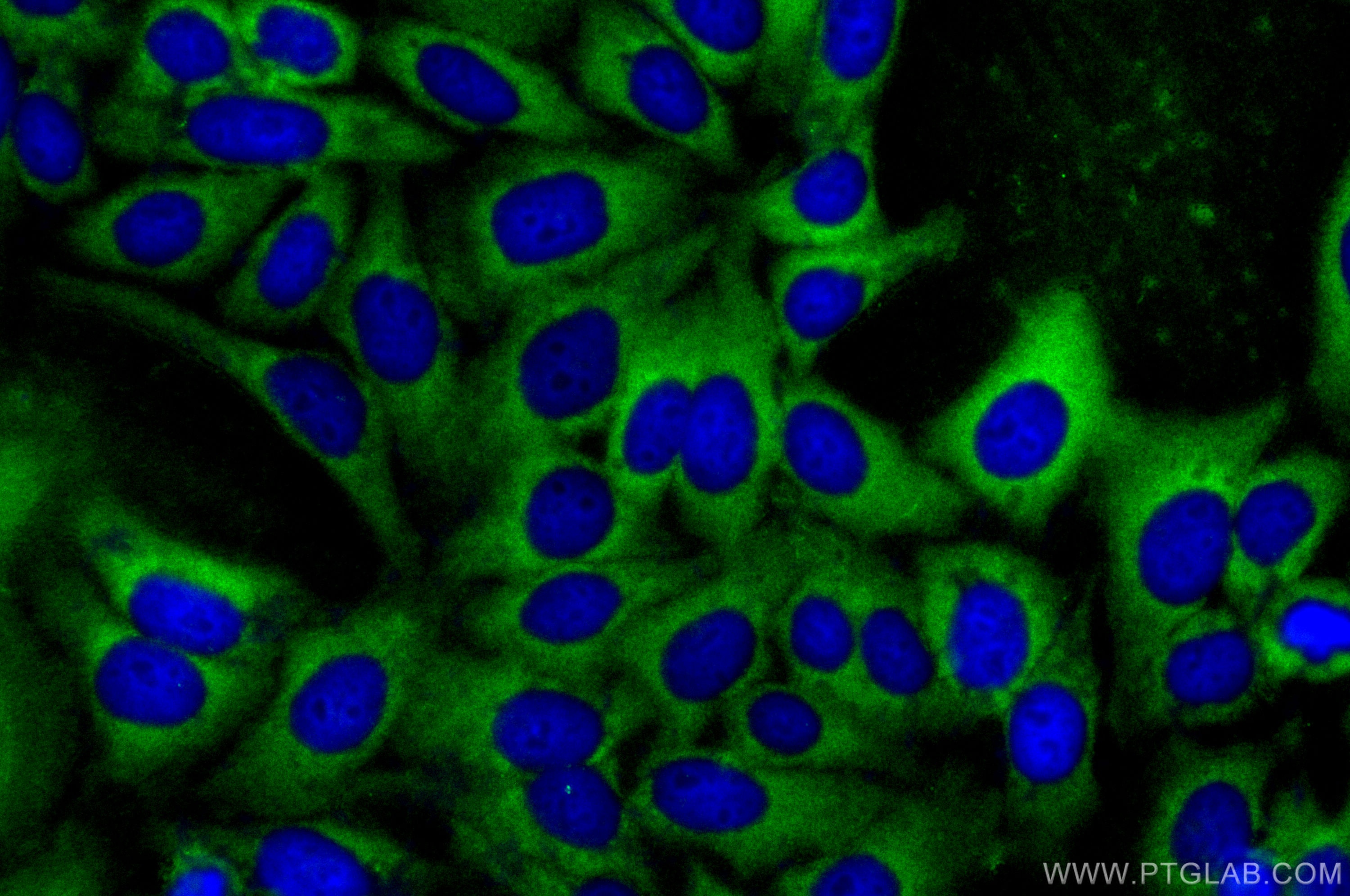 Immunofluorescence (IF) / fluorescent staining of HepG2 cells using KPNA3 Polyclonal antibody (28050-1-AP)