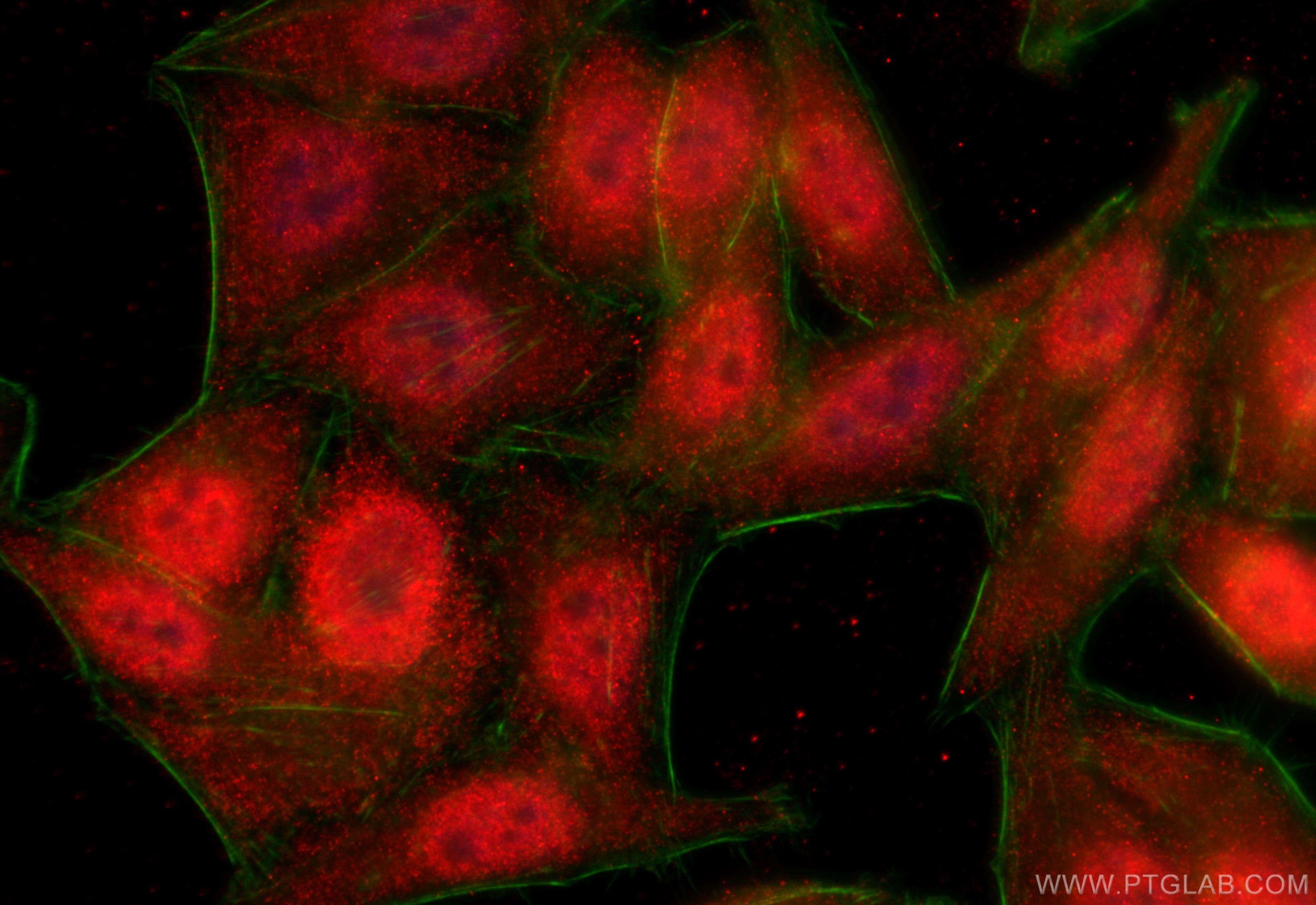 Immunofluorescence (IF) / fluorescent staining of HepG2 cells using KPNA3 Polyclonal antibody (28050-1-AP)