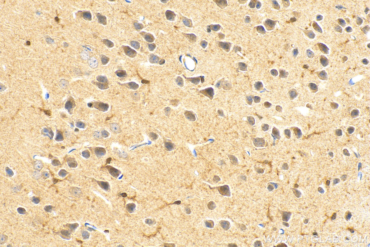 Immunohistochemistry (IHC) staining of mouse brain tissue using KPNA3 Polyclonal antibody (28050-1-AP)