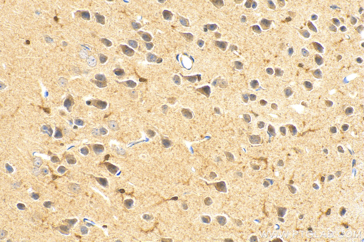 IHC staining of mouse brain using 28050-1-AP