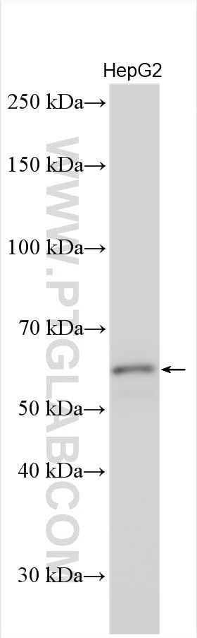 Western Blot (WB) analysis of various lysates using KPNA3 Polyclonal antibody (28050-1-AP)