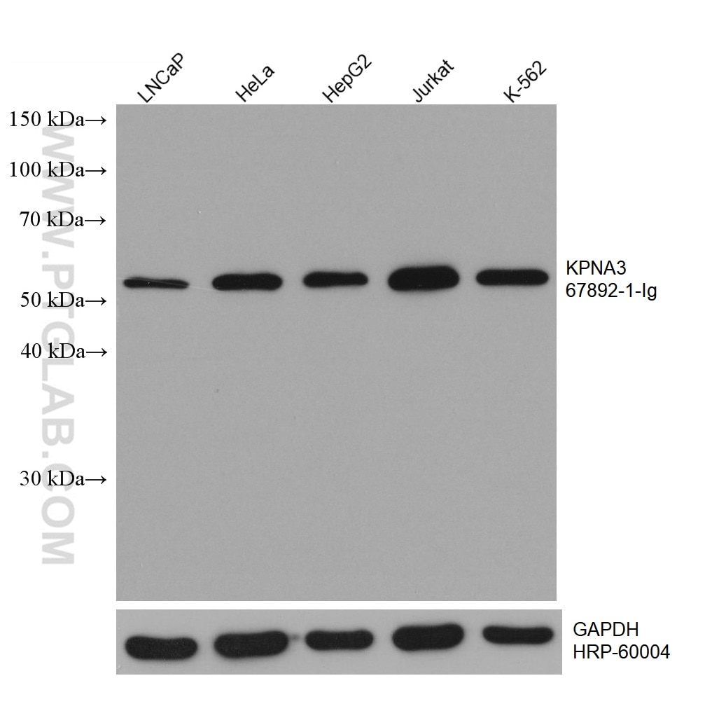 Western Blot (WB) analysis of various lysates using KPNA3 Monoclonal antibody (67892-1-Ig)