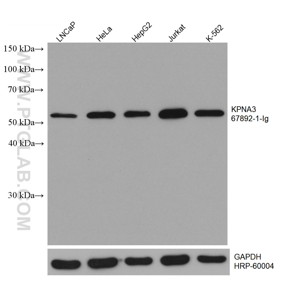 WB analysis using 67892-1-Ig