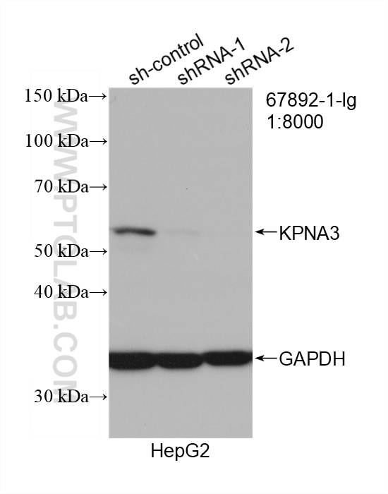 Western Blot (WB) analysis of HepG2 cells using KPNA3 Monoclonal antibody (67892-1-Ig)