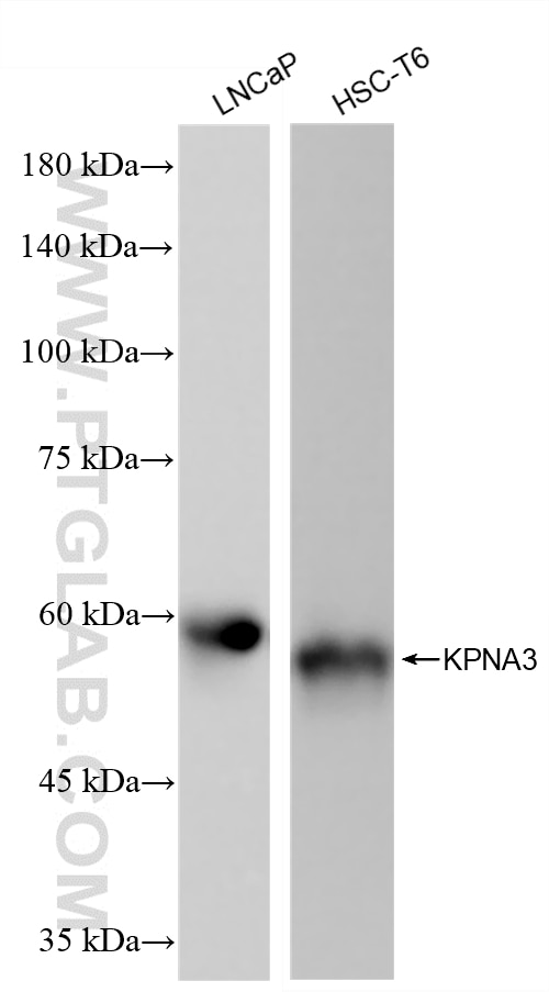 Western Blot (WB) analysis of various lysates using KPNA3 Recombinant monoclonal antibody (86722-1-RR)