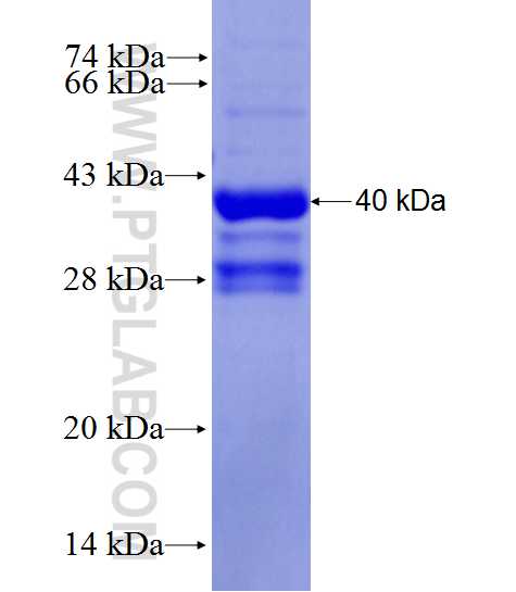 KPNA3 fusion protein Ag27755 SDS-PAGE