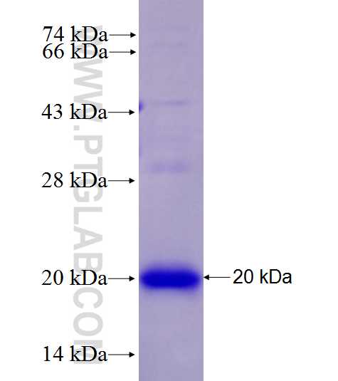 KPNA3 fusion protein Ag27767 SDS-PAGE