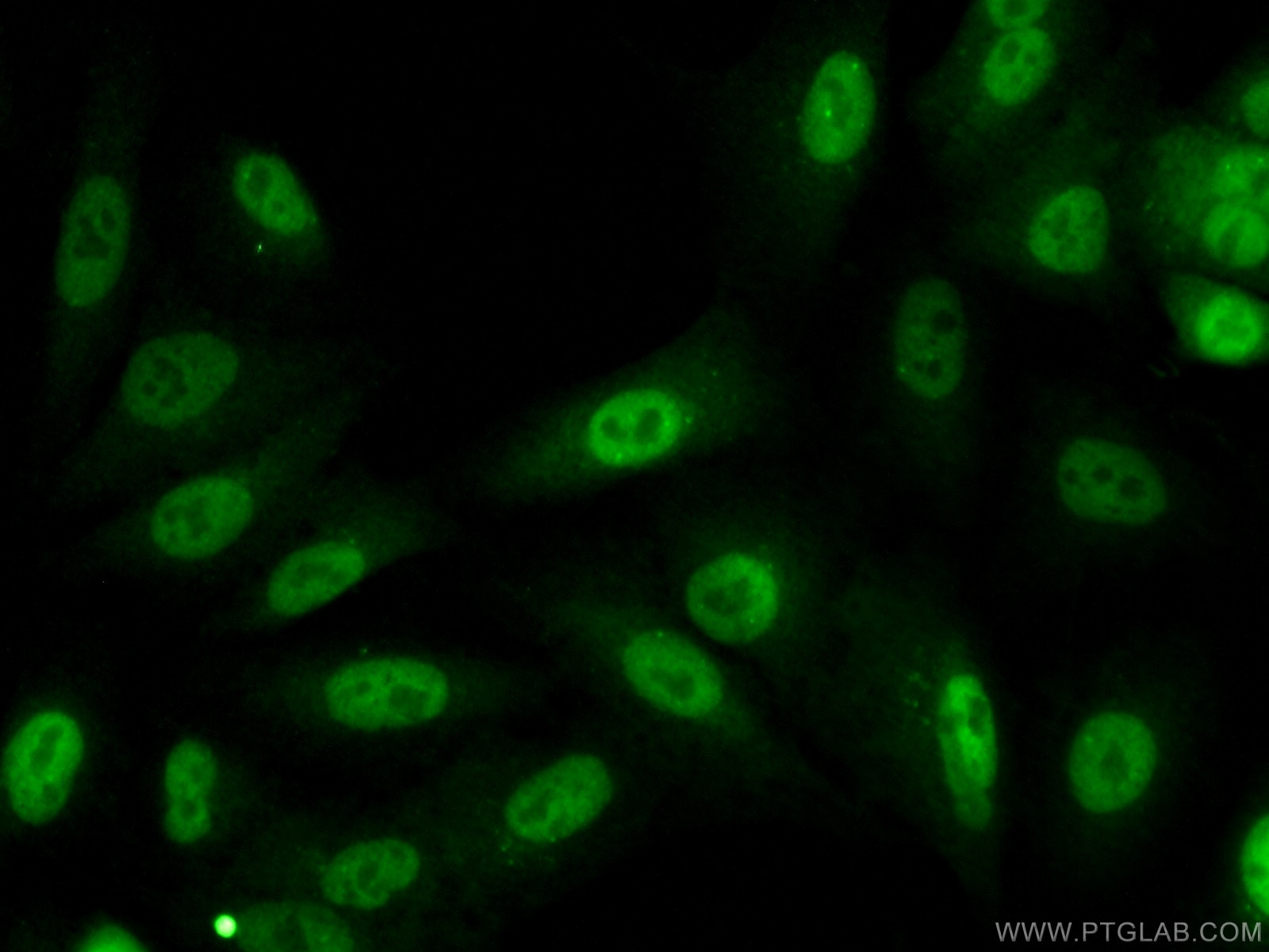 Immunofluorescence (IF) / fluorescent staining of A549 cells using KPNA4 Polyclonal antibody (12463-1-AP)