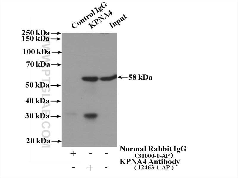 Immunoprecipitation (IP) experiment of A549 cells using KPNA4 Polyclonal antibody (12463-1-AP)