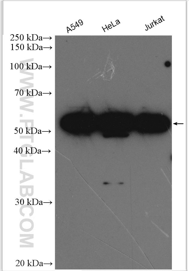 Western Blot (WB) analysis of various lysates using KPNA4 Polyclonal antibody (12463-1-AP)