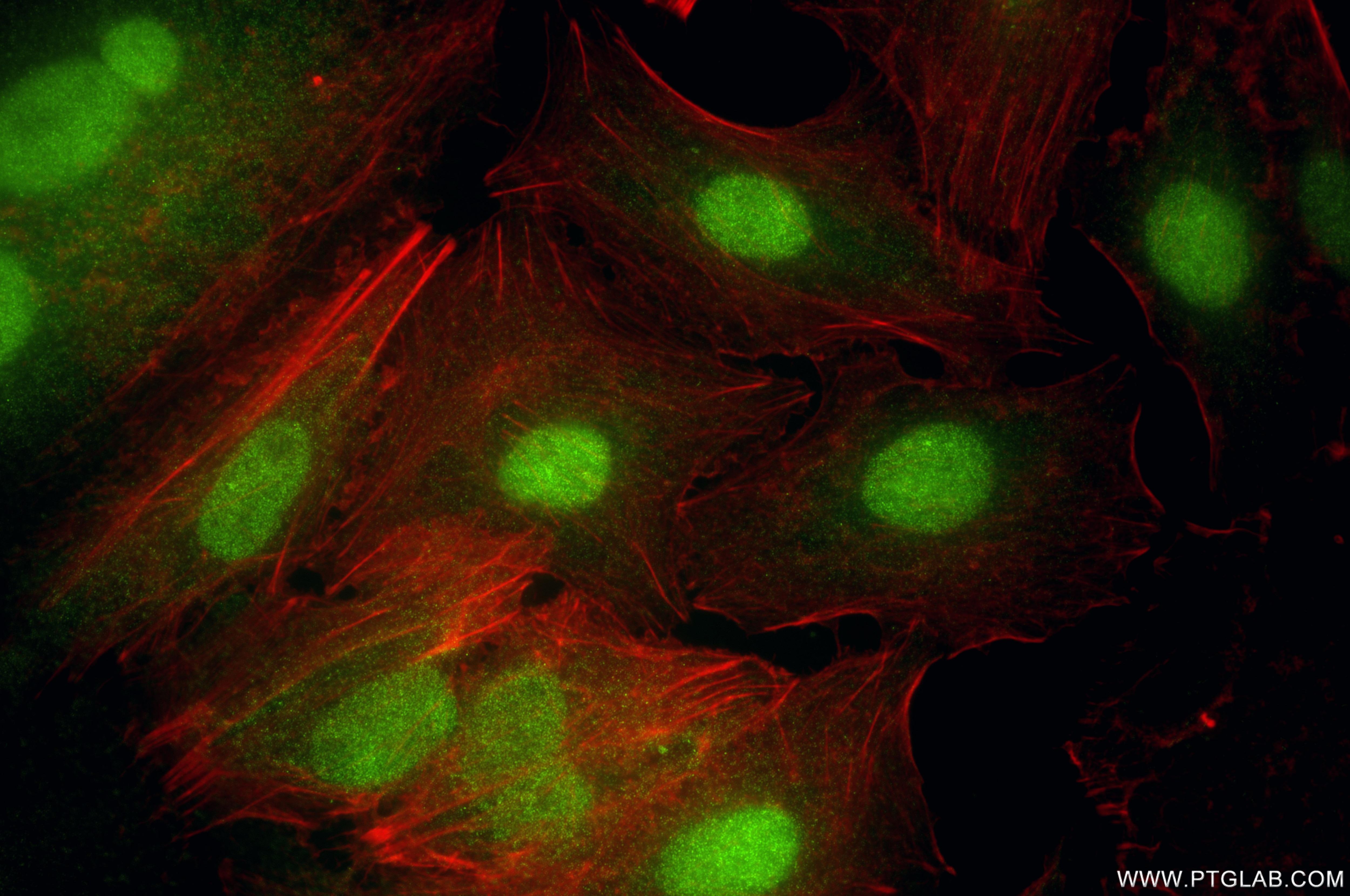 Immunofluorescent analysis of (4% PFA) fixed A549 cells using KPNA4 antibody (82898-1-RR, Clone: 230098H3 ) at dilution of 1:1000 and CoraLite®488-Conjugated Goat Anti-Rabbit IgG(H+L) (SA00013-2), CL594-Phalloidin (red). Immunofluorescence (IF) / fluorescent staining of A549 cells using KPNA4 Recombinant monoclonal antibody (82898-1-RR)