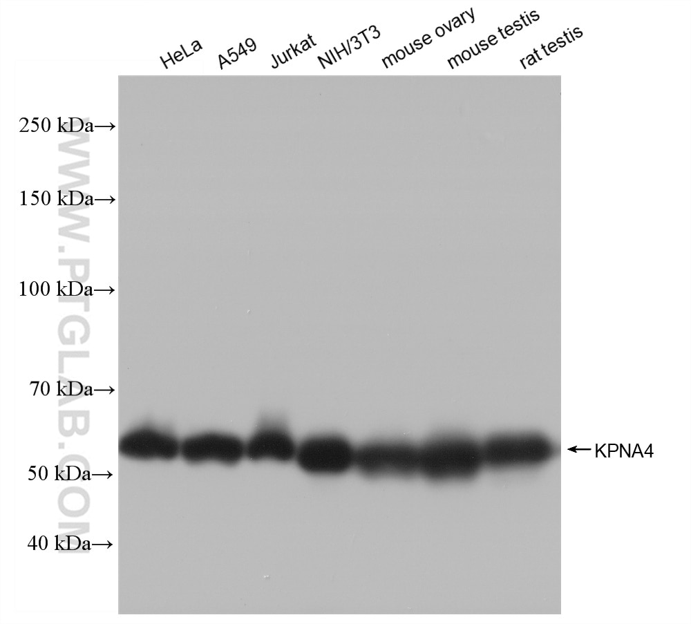 Western Blot (WB) analysis of various lysates using KPNA4 Recombinant antibody (82898-2-RR)