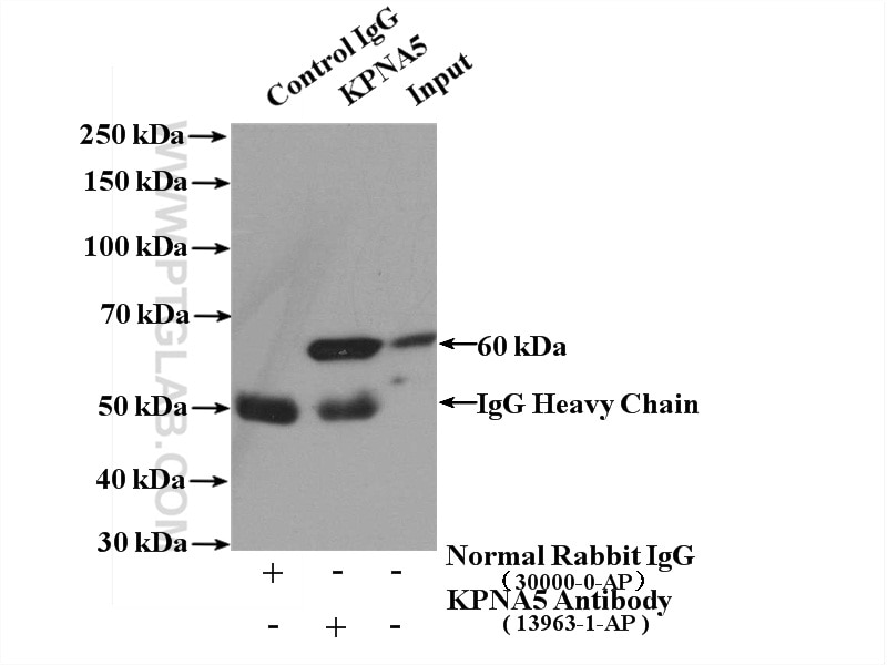 Immunoprecipitation (IP) experiment of Jurkat cells using KPNA5 Polyclonal antibody (13963-1-AP)