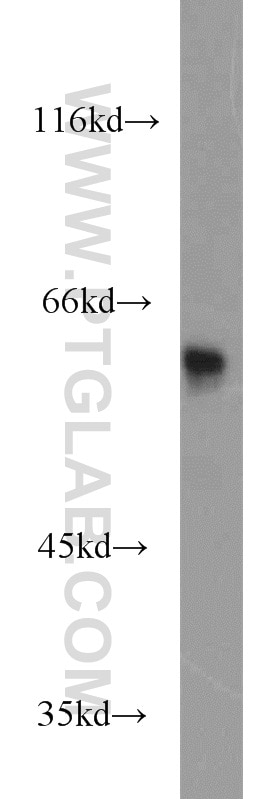 Western Blot (WB) analysis of Jurkat cells using KPNA5 Polyclonal antibody (13963-1-AP)